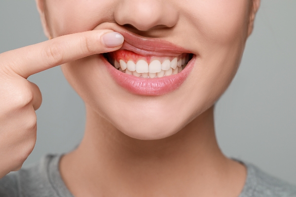 The Importance Of Early Detection In Gum Disease Treatment